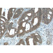 Solarbio K009783P Anti-NUPR1 Polyclonal Antibody