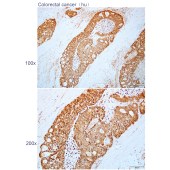 Solarbio K112256P Anti-ANGEL2 Polyclonal Antibody