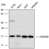 Solarbio K110491P Anti-GEMIN6 Polyclonal Antibody