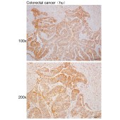 Solarbio K110373P Anti-METTL17 Polyclonal Antibody
