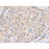 Solarbio K009805P Anti-SHC3 Polyclonal Antibody
