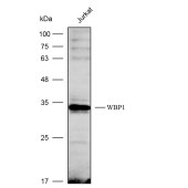 Solarbio K112271P Anti-WBP1 Polyclonal Antibody