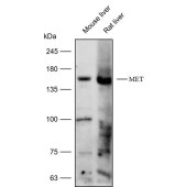 Solarbio K112177P Anti-MET Polyclonal Antibody