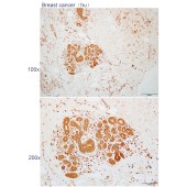Solarbio K112217P Anti-SLC25A10 Polyclonal Antibody