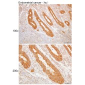 Solarbio K109945P Anti-CAPRIN1 Polyclonal Antibody