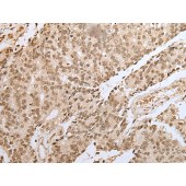 Solarbio K009817P Anti-ZNF22 Polyclonal Antibody