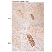 Solarbio K112190P Anti-DCC Polyclonal Antibody