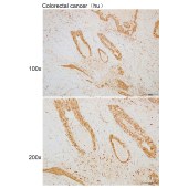 Solarbio K110127P Anti-RAPGEF4 Polyclonal Antibody