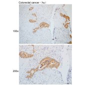 Solarbio K110135P Anti-KCNK9 Polyclonal Antibody