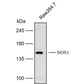 Solarbio K112193P Anti-NOS1 Polyclonal Antibody