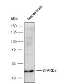 Solarbio K112259P Anti-STARD3 Polyclonal Antibody