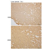 Solarbio K110324P Anti-PROKR1 Polyclonal Antibody