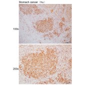 Solarbio K110383P Anti-KLHL6 Polyclonal Antibody