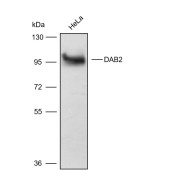 Solarbio K009798P Anti-DAB2 Polyclonal Antibody