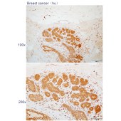 Solarbio K112275P Anti-CPNE2 Polyclonal Antibody
