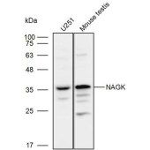 Solarbio K110006P Anti-NAGK Polyclonal Antibody