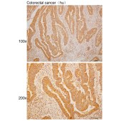 Solarbio K110481P Anti-COG4 Polyclonal Antibody