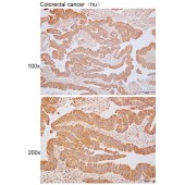 Solarbio K110377P Anti-STK24 Polyclonal Antibody