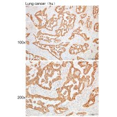 Solarbio K109959P Anti-KRT8 Polyclonal Antibody