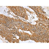 Solarbio K009860P Anti-PREPL Polyclonal Antibody