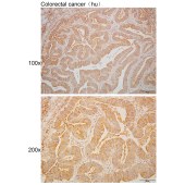 Solarbio K110406P Anti-PDP2 Polyclonal Antibody