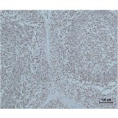 Solarbio K000212M Anti-PARP Monoclonal Antibody