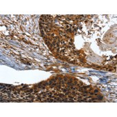 Solarbio K009801P Anti-TWF1 Polyclonal Antibody