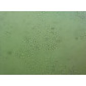 吉妮欧 JNO-H0269 C-33A 人宫颈癌细胞