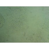 吉妮欧 JNO-H0148 T84 人结直肠癌细胞