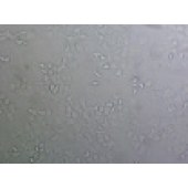 吉妮欧 JNO-H0204 KYSE-30 人食管确癌细胞