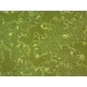 吉妮欧 JNO-H0365 MDA-MB-361 人乳腺癌细胞