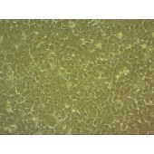 吉妮欧 JNO-H0381 BHT101 人甲状腺癌细胞