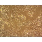 吉妮欧 JNO-H0374 HCC1569 人乳腺癌细胞