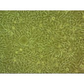 吉妮欧 JNO-H0664 EBC-1 人肺癌鳞癌细胞