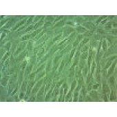 吉妮欧 JNO-H0332 SW982 人滑膜肉瘤细胞