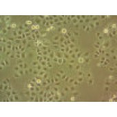 吉妮欧 JNO-H0295 HO-8910PM 人高转移卵巢癌细胞