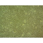 吉妮欧 JNO-H0696 HCC1143 人乳腺导管癌细胞
