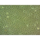 吉妮欧 JNO-H0390 TPC-1 人乳头瘤状甲状腺癌细胞