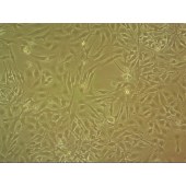 吉妮欧 JNO-H0395 FTC-238 人类滤泡状甲状腺癌细胞
