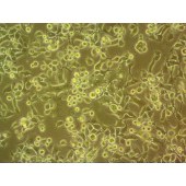 吉妮欧 JNO-H0676 H1869 人非小细胞肺癌鳞癌细胞