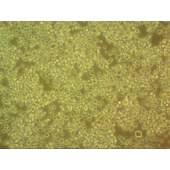 吉妮欧 JNO-H0435 SU-DHL-2 人弥漫性组织淋巴瘤细胞