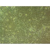 吉妮欧 JNO-Y0179 CNE2/DDP 人鼻咽癌细胞(高分化)耐顺铂