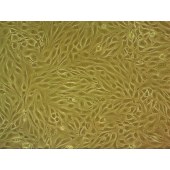 吉妮欧 JNO-M0078 bEnd.3 小鼠脑微血管内皮细胞