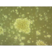 吉妮欧 JNO-H0670 GM24385 人 类成淋巴细胞