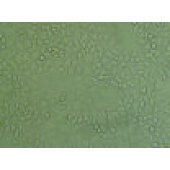 吉妮欧 JNO-H0268 AN3CA 人子宫内膜腺癌（转移）细胞