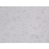 TSINGKE TC‒H0178 PA-1 人卵巢畸胎瘤细胞