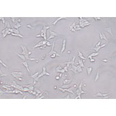 TSINGKE TC‒H0265 SH-SY5Y 人神经母细胞瘤细胞