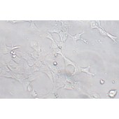 TSINGKE TC‒R0018 4T1 小鼠乳腺癌细胞