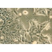 TSINGKE TC‒H0133 Detroit 562 人咽头癌胸水转移细胞