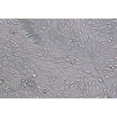 TSINGKE TC‒R0025 SV40 MES 13 小鼠肾小球系膜细胞